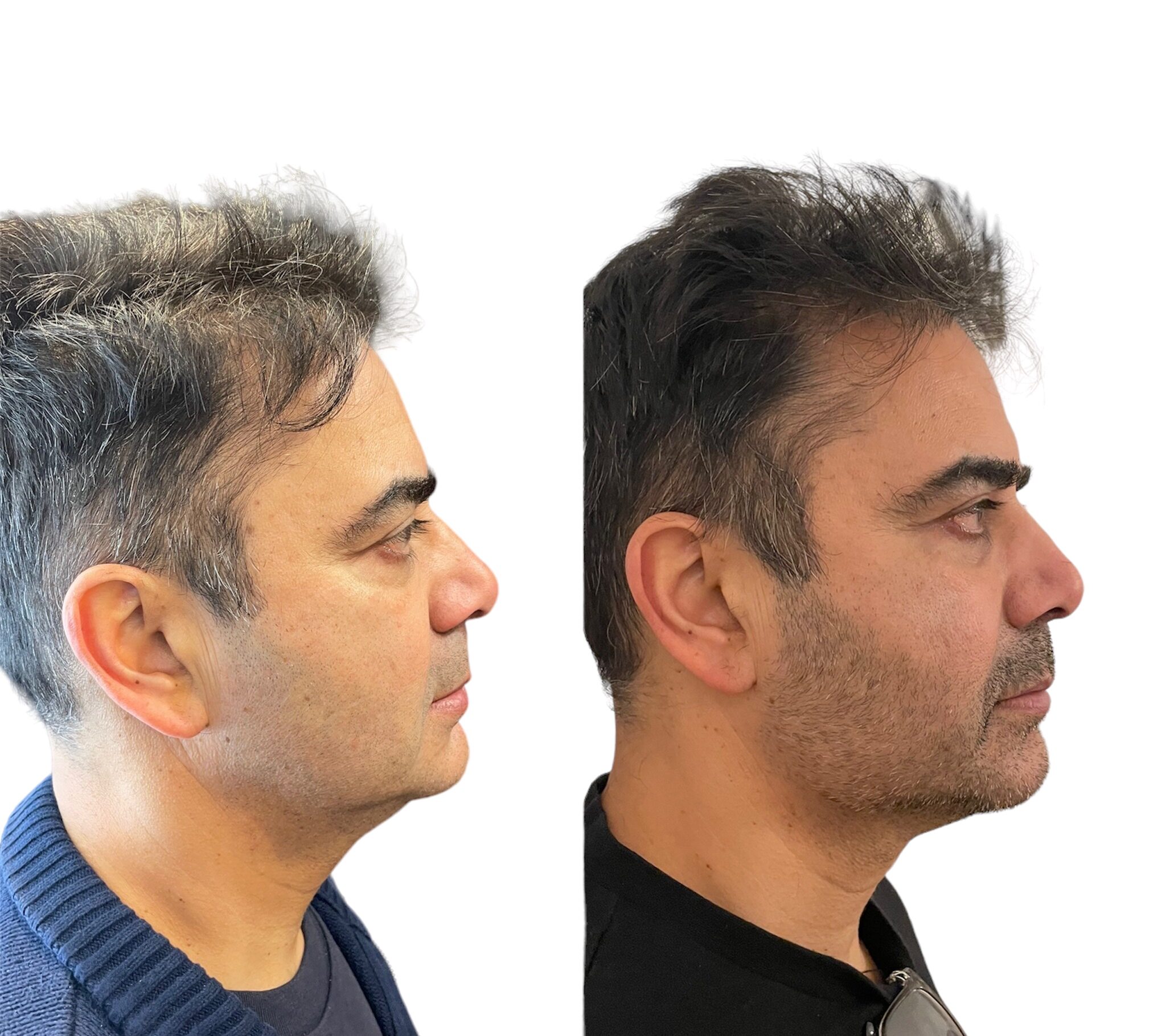 PhotoRoom_20230826_230230