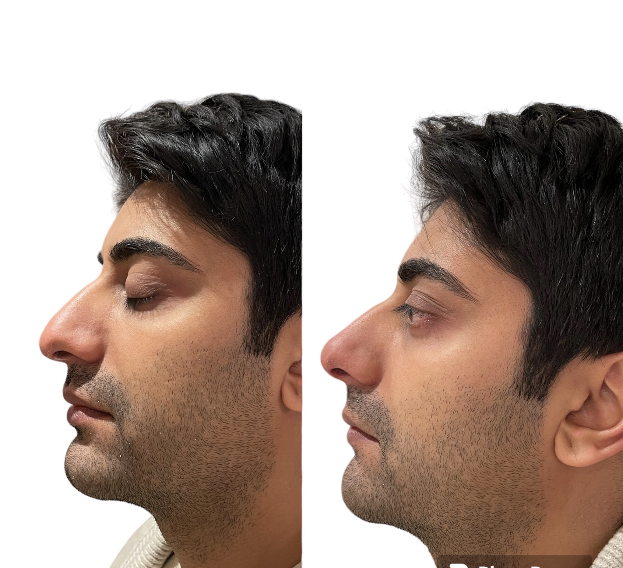 PhotoRoom_20230826_230750