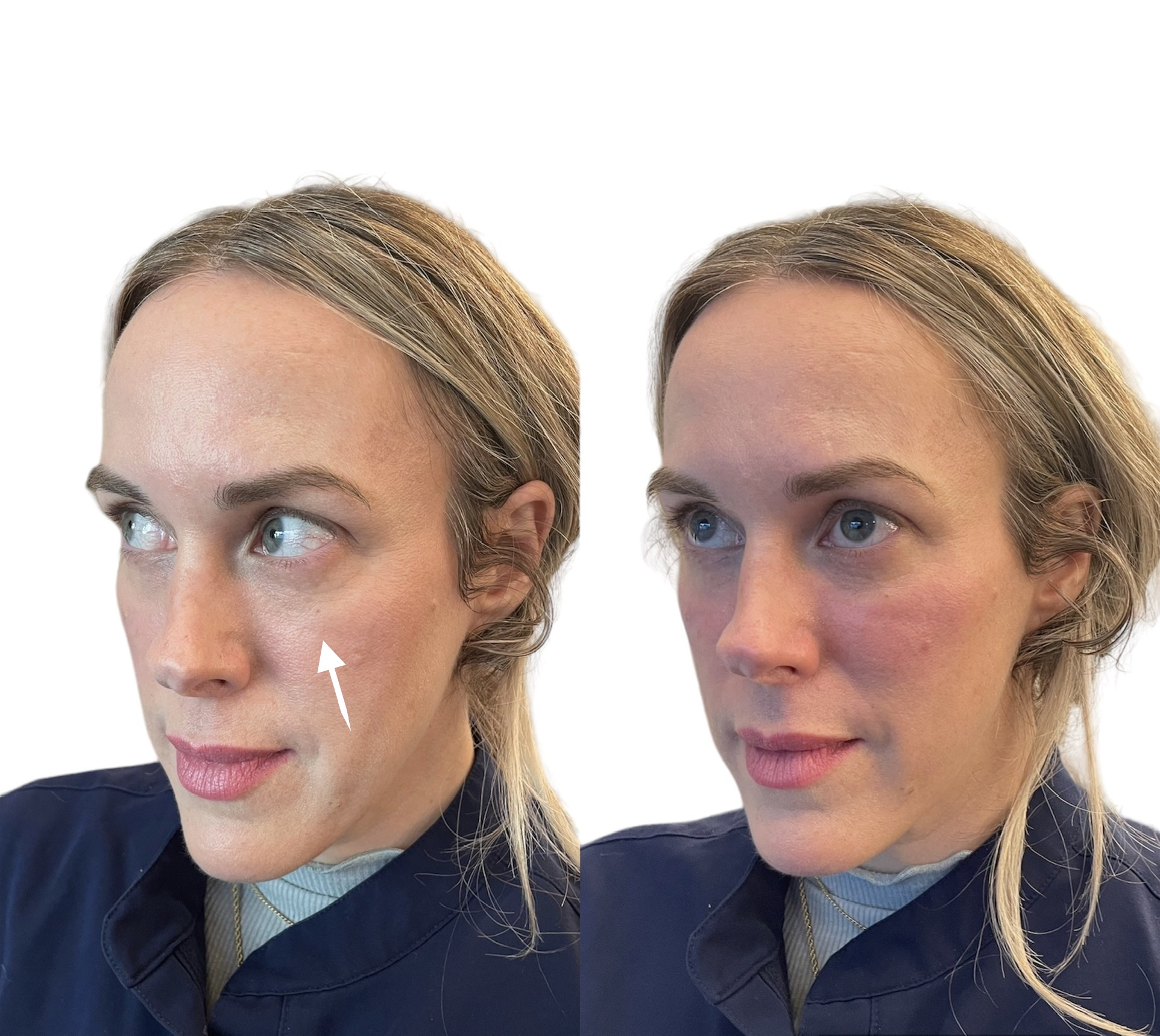 PhotoRoom_20240131_113543