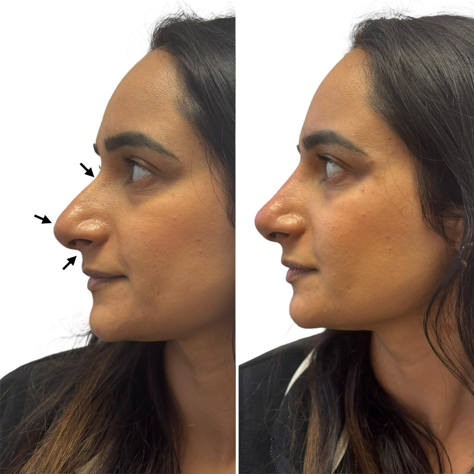 d4a6e46c-aafb-43d4-be65-7a6b6c68c0c1